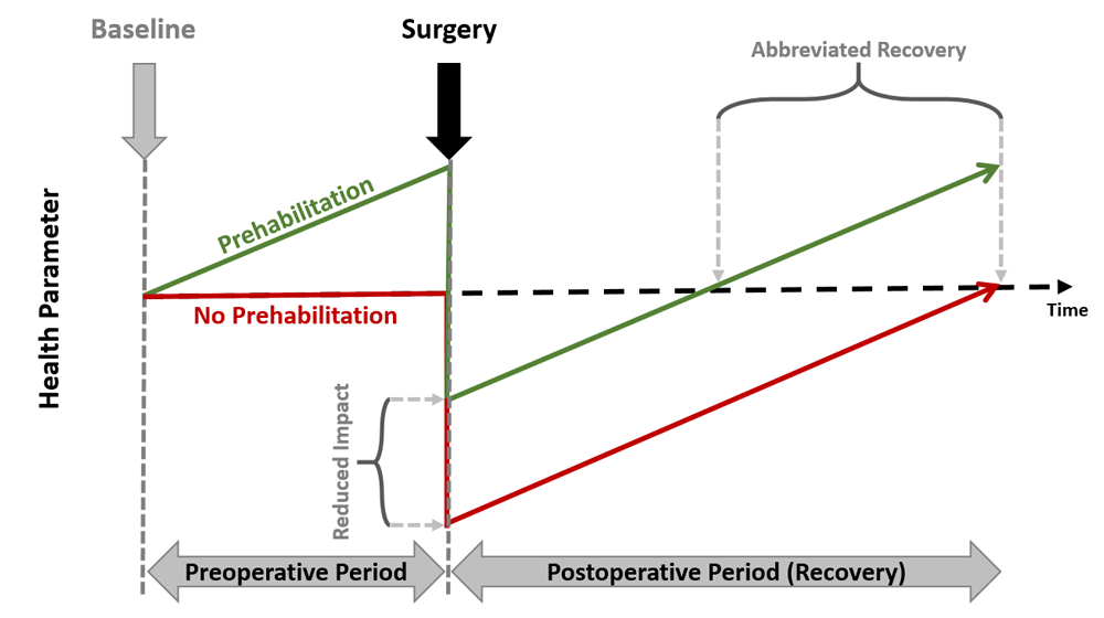 Abbildung 1. Prehabilitation model (Modifiziert nach Carli et al., 2017)36